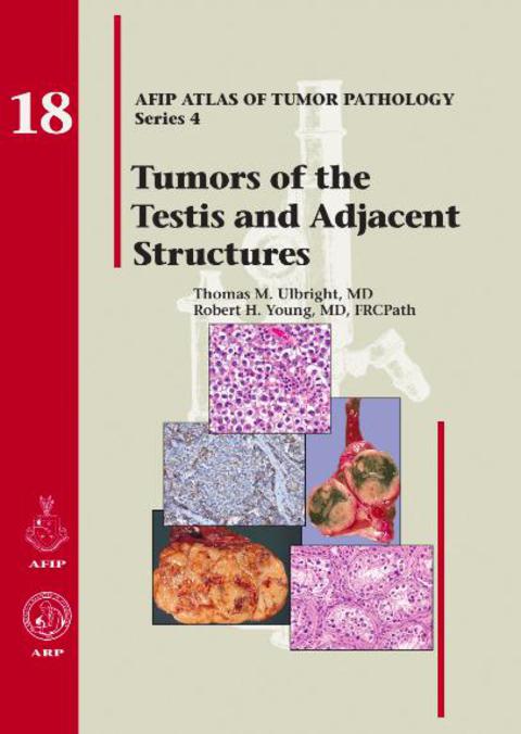 Cover image for book Tumors of the Testis and Adjacent Structures