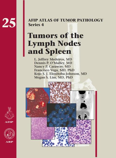 Cover image for book Tumors of the Lymph, Node and Spleen