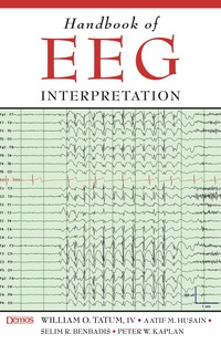 Handbook of EEG Interpretation 1st edition | 9781933864112 ...