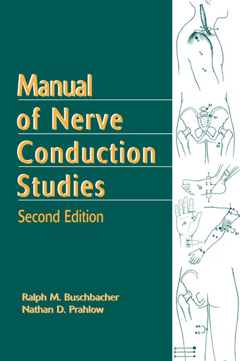 Cover image for book Manual of Nerve Conduction Studies