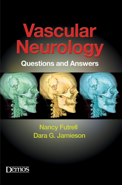 Cover image for book Vascular Neurology
