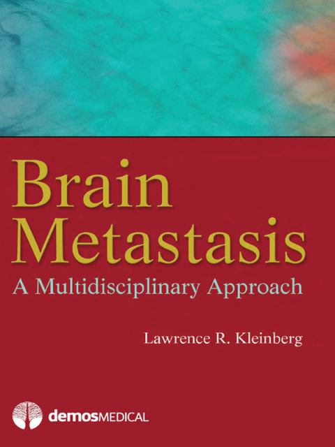 Cover image for book Brain Metastasis