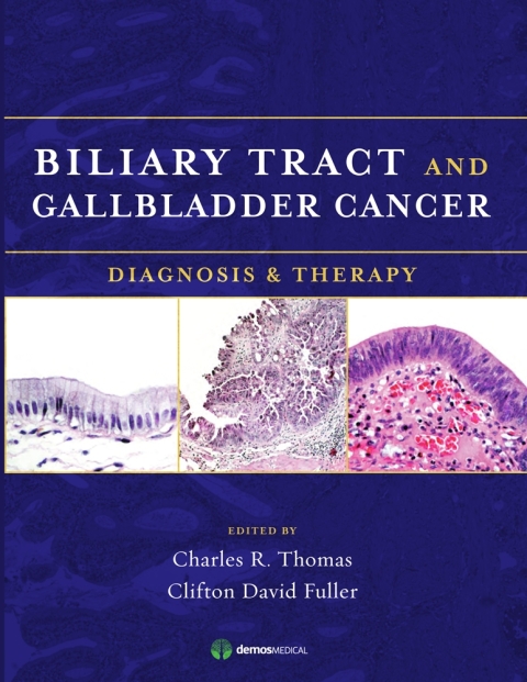 Cover image for book Biliary Tract and Gallbladder Cancer
