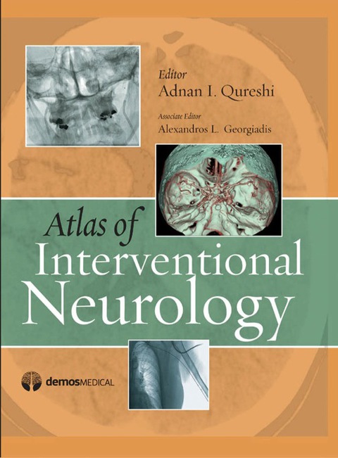 Cover image for book Atlas of Interventional Neurology