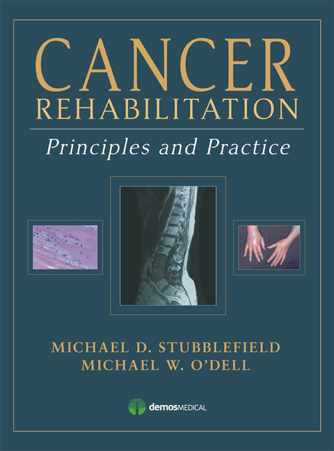 Cover image for book Cancer Rehabilitation