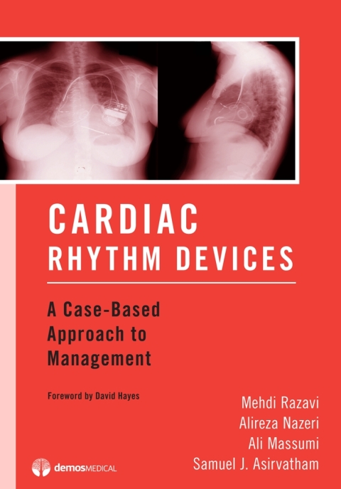 Cover image for book Cardiac Rhythm Devices