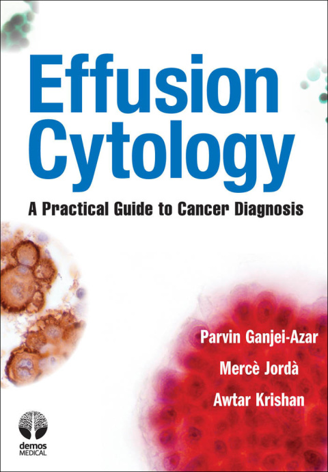 Effusion Cytology 