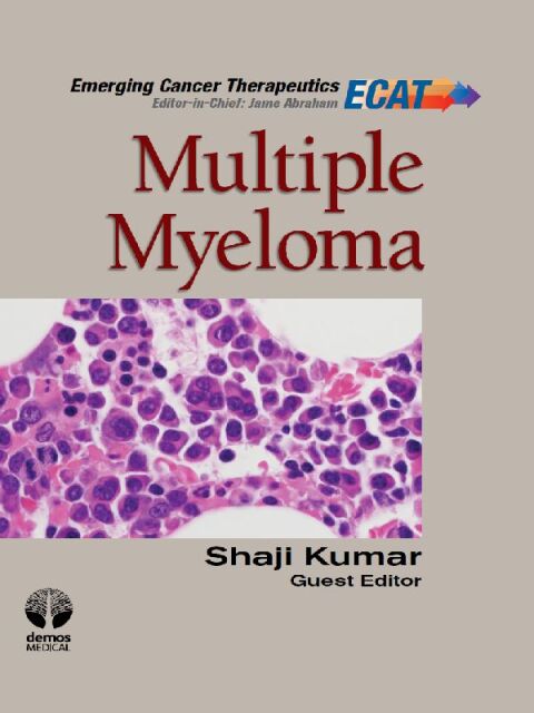 Cover image for book Multiple Myeloma