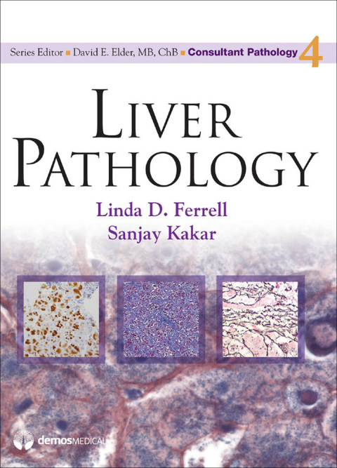Cover image for book Liver Pathology