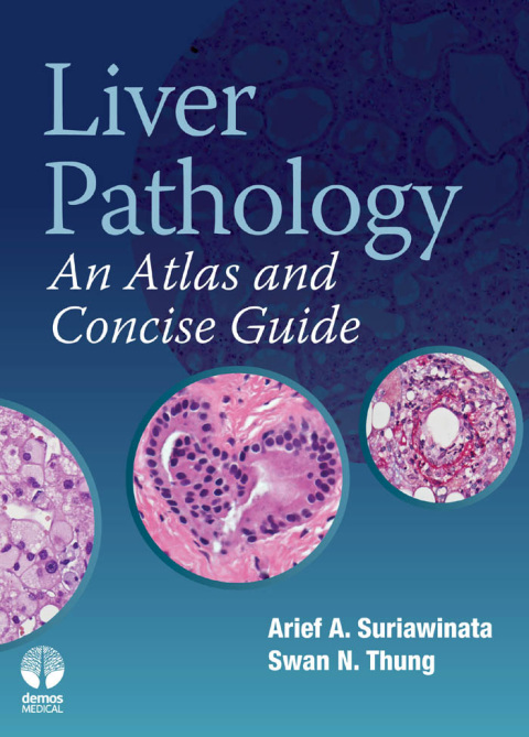 Cover image for book Liver Pathology