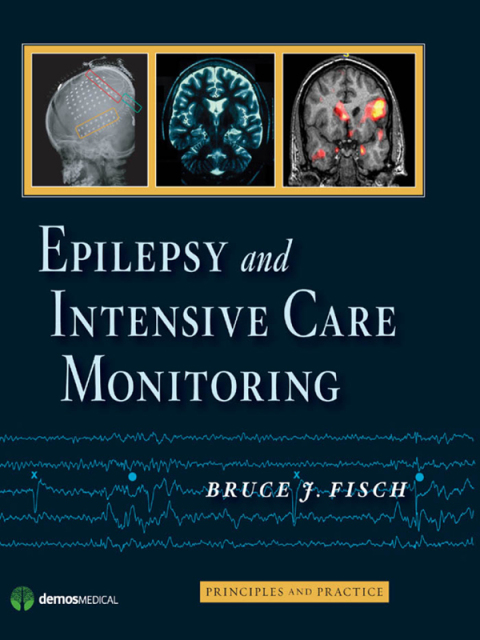 Cover image for book Epilepsy and Intensive Care Monitoring