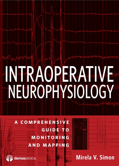 Cover image for book Intraoperative Neurophysiology