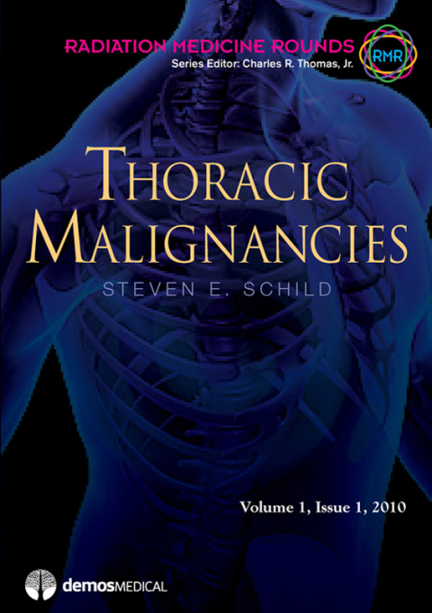 Cover image for book Thoracic Malignancies