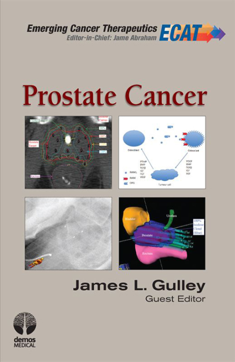 Cover image for book Prostate Cancer