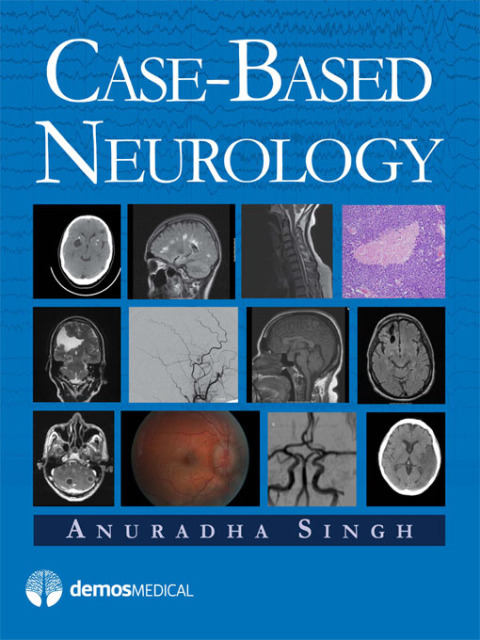 Case-Based Neurology 