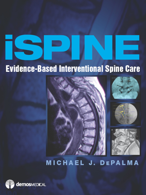 Cover image for book iSpine