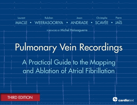 Pulmonary Vein Recordings : A Practical Guide to the Mapping and Ablation of Atrial Fibrillation Vol 3 