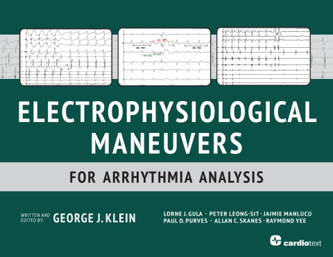 Electrophysiological Maneuvers for Arrhythmia Analysis 