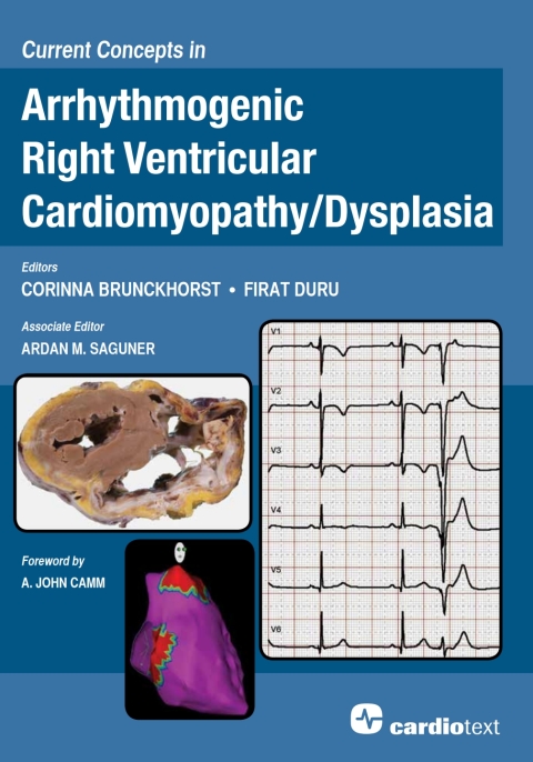 Cover image for book Current Concepts in Arrhythmogenic Right Ventricular Cardiomyopathy/Dysplasia