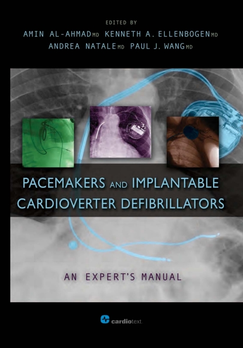 Cover image for book Pacemakers and Implantable Cardioverter Defibrillators: An Expert's Manual