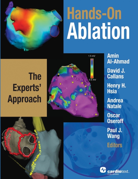 Hands-On Ablation: The Experts' Approach 
