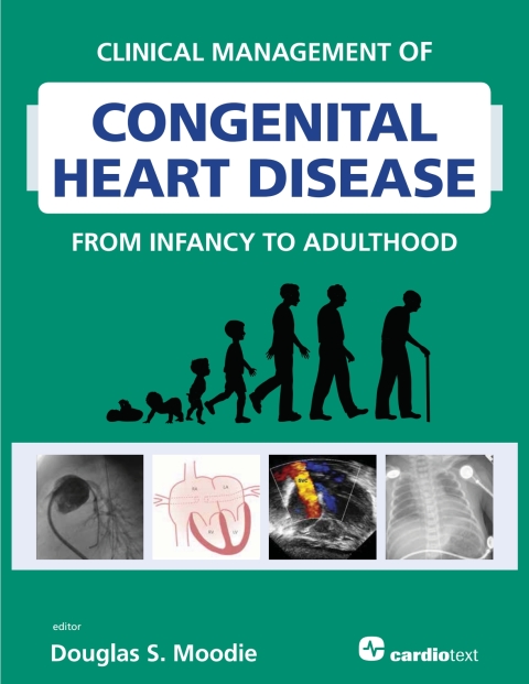 Cover image for book Clinical Management of Congenital Heart Disease from Infancy to Adulthood