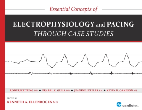 Cover image for book Essential Concepts of Electrophysiology and Pacing through Case Studies