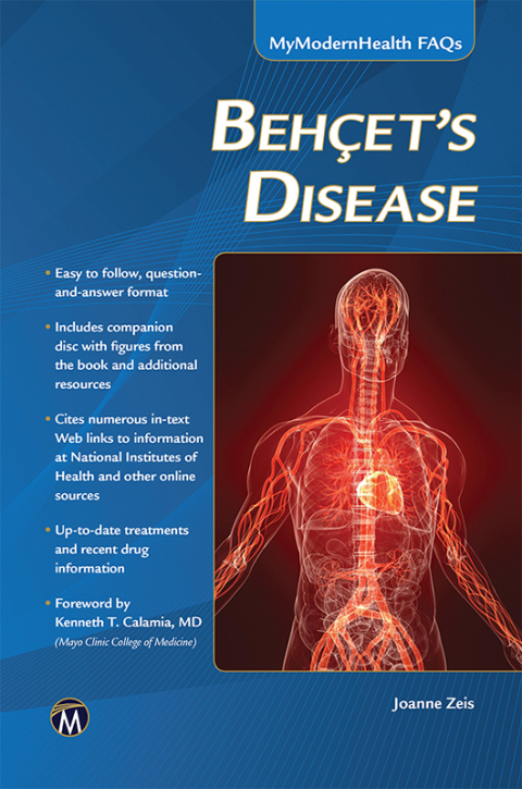 Cover image for book Behcet’s Disease