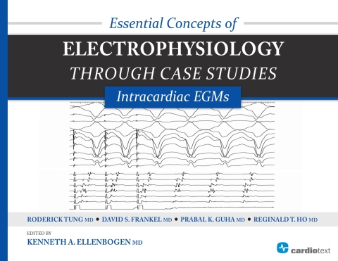 Essential Concepts of Electrophysiology through Case Studies: Intracardiac EGMs 