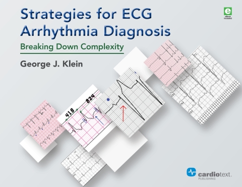 Strategies for ECG Arrhythmia Diagnosis 