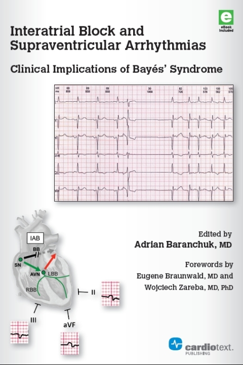 Cover image for book Interatrial Block and Supraventricular Arrhythmias: Clinical Implications of Bayés Syndrome