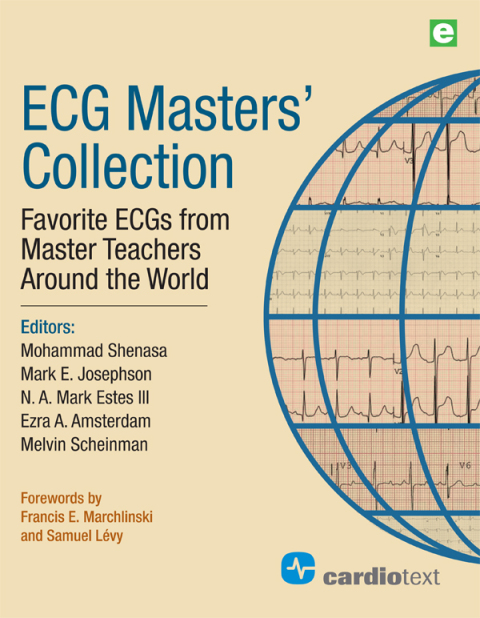 ECGÂ Masters Collection 