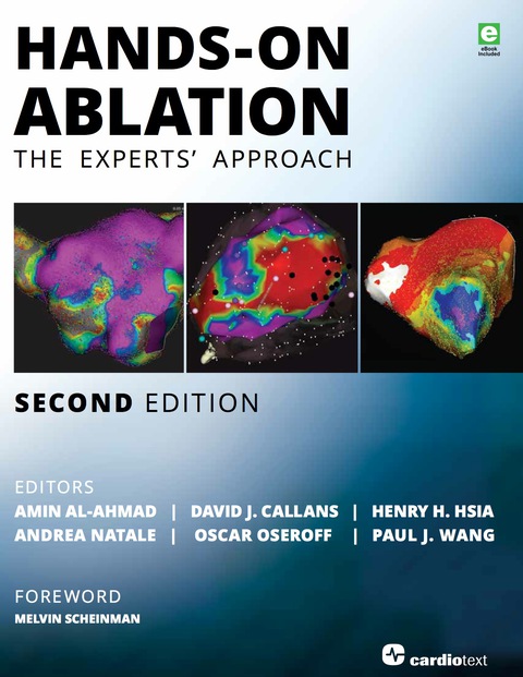Hands-On Ablation 
