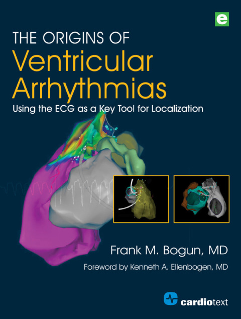 The Origins of Ventricular Arrhythmias 