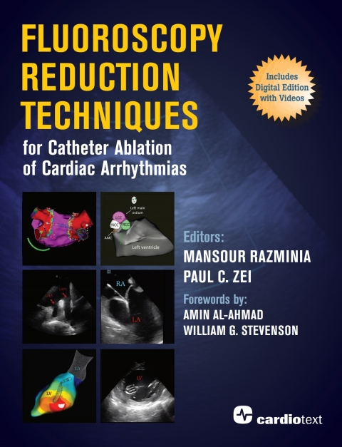 Fluoroscopy Reduction Techniques for Catheter Ablation of Cardiac Arrhythmias 