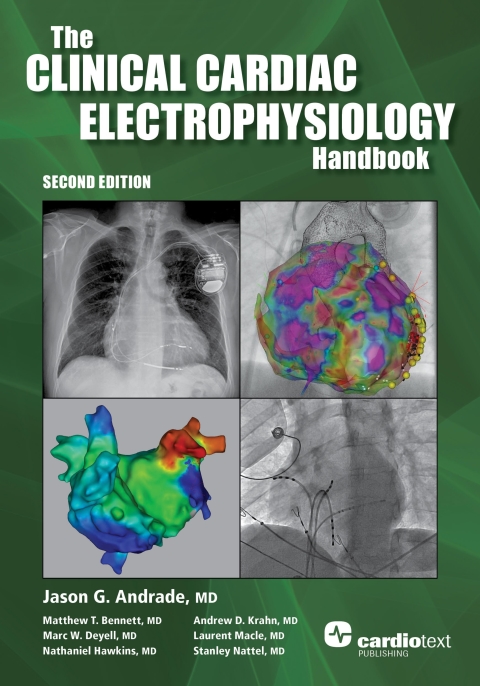 Clinical Cardiac Electrophysiology Handbook, Second Edition 