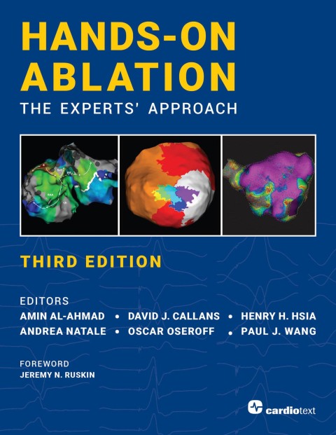 Hands-On Ablation, The Experts' Approach, Third Edition 
