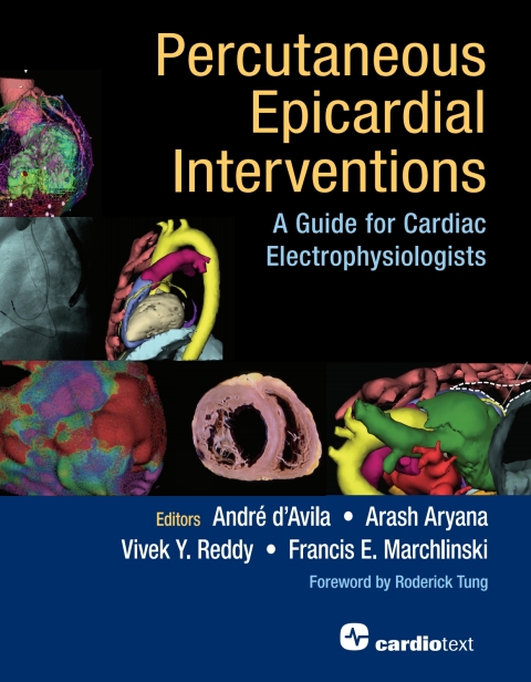 Percutaneous Epicardial Interventions: 