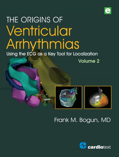 The Origins of Ventricular Arrhythmias, Volume 2 