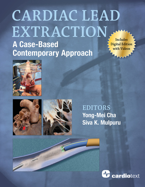 Cardiac Lead Extraction: A Case-Based Contemporary Approach 