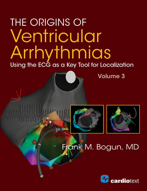 The Origins of Ventricular Arrhythmias: Using the ECG as a Key Tool for Localization, Volume 3 