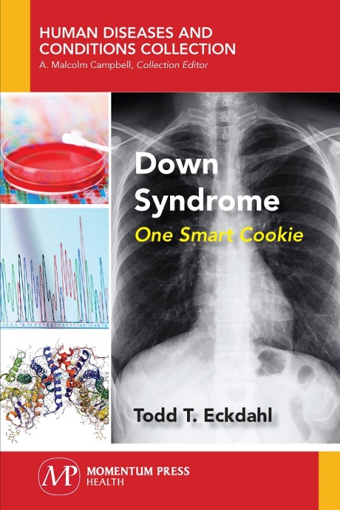 Cover image for book Down Syndrome