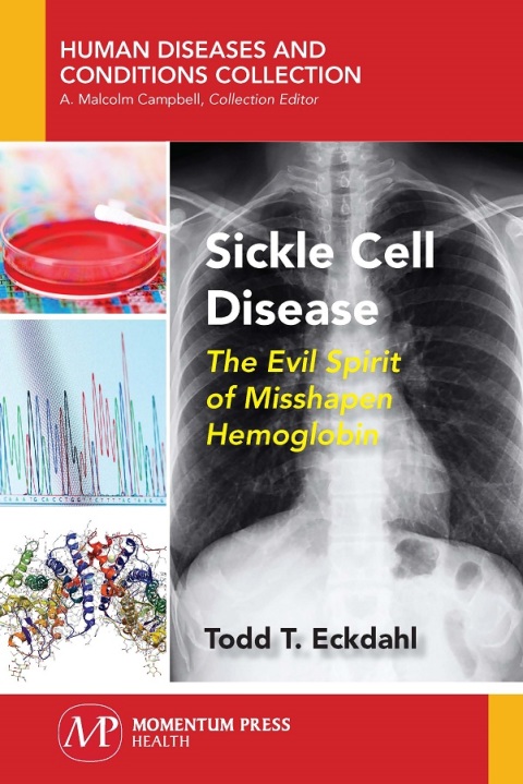 Cover image for book Sickle Cell Disease