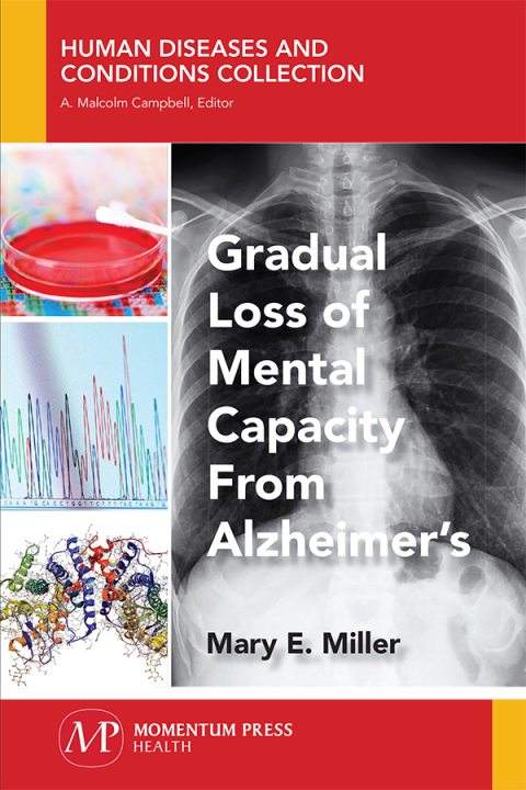 Cover image for book Gradual Loss of Mental Capacity from Alzheimer’s