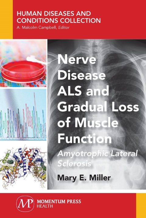 Cover image for book Nerve Disease ALS and Gradual Loss of Muscle Function