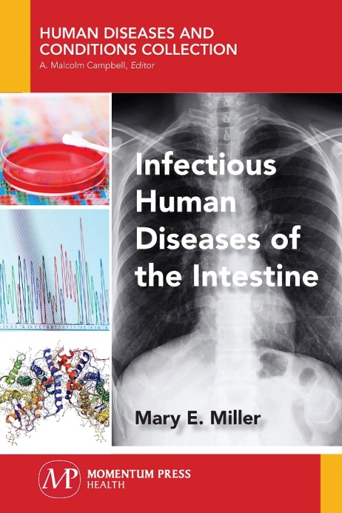 Infectious Human Diseases of the Intestine 