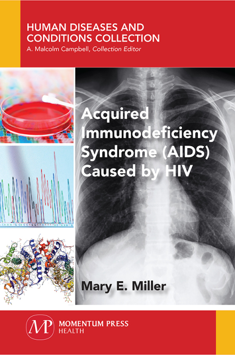 Cover image for book Acquired Immunodeficiency Syndrome (AIDS) Caused by HIV