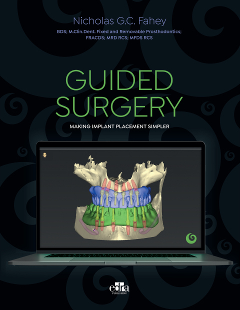 Guided surgery - Making implant placement simpler 