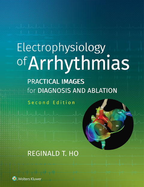 Cover image for book Electrophysiology of Arrhythmias