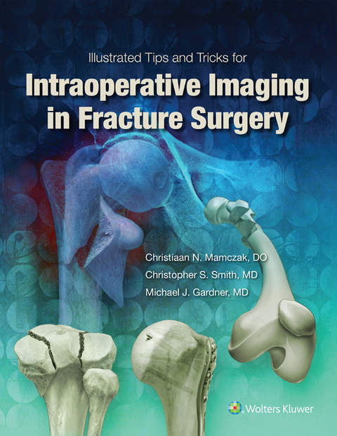 Cover image for book Illustrated Tips and Tricks for Intraoperative Imaging in Fracture Surgery